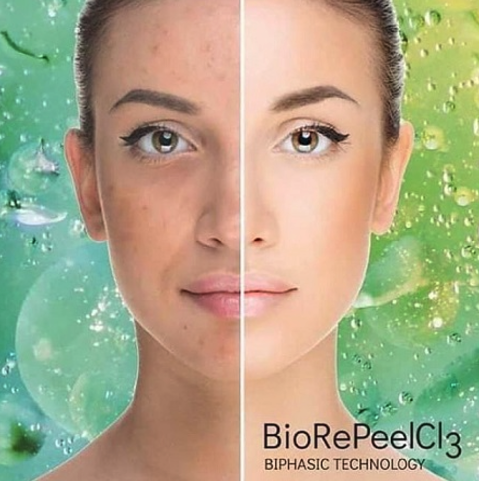 BioRePeel CL3